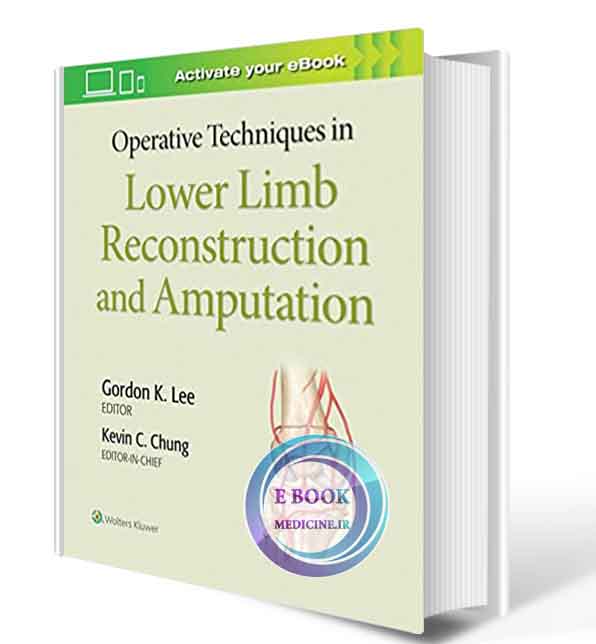 دانلود کتابOperative Techniques in Lower Limb Reconstruction and Amputation null 2019  (  PDF)